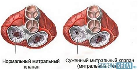 Анатомическое строение митрального клапана