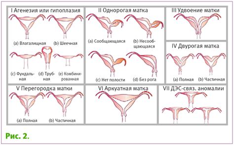 Аномалии шейки матки