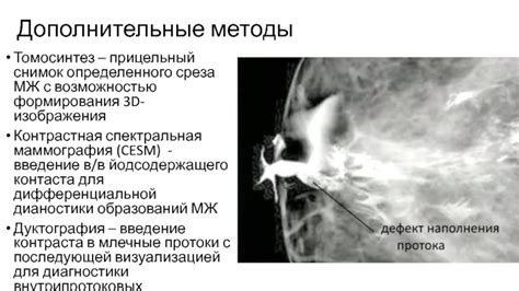 Виды маммографии