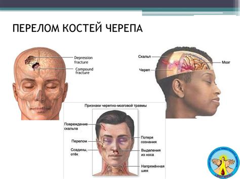 Внешние признаки "прелестности"