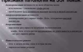 Возможные последствия дезорганизованной активности ЭЭГ и лечение