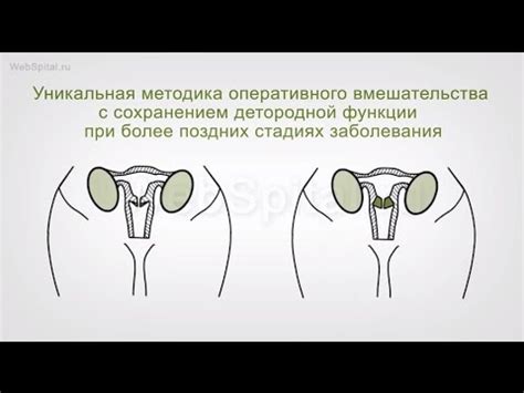 Возможные причины отсутствия лимфоваскулярной инвазии