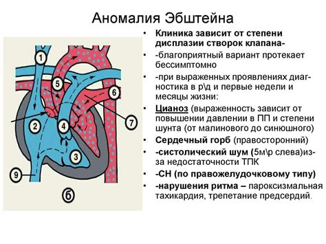 Врожденные аномалии строения сердца