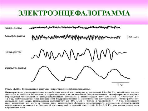 Диагностика и обнаружение дезорганизованной активности ЭЭГ