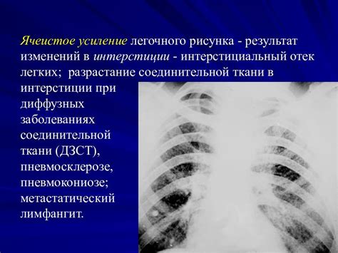 Диагностика и обследование усиления сосудистого рисунка