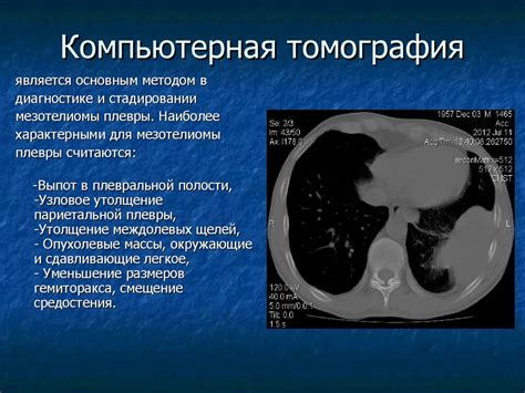 Диагностика утолщения костальной плевры