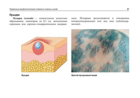 Заболевания, вызывающие почернение кожи