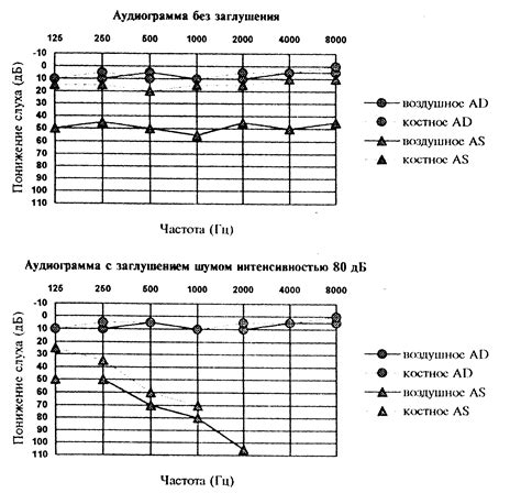 Звуковое воздействие шепотной речи на мозг