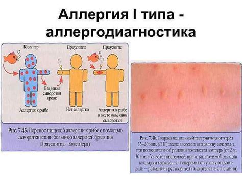 Значение красной носовой кончика в диагностике аллергических реакций