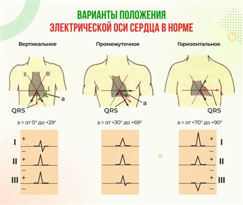 Как интерпретировать отправку сердца