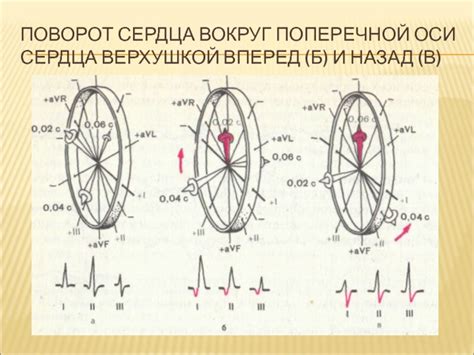 Клиническое значение и последствия поворота сердца верхушкой назад