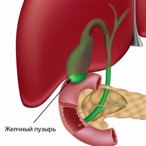 Лечение высыхания желчного пузыря