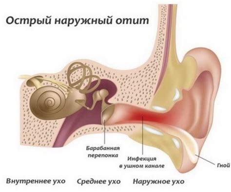 Лечение отрезанного уха