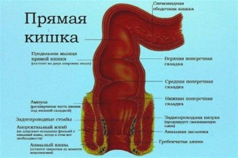 Лечение очаговой гиперплазии слизистой прямой кишки: методы и процедуры