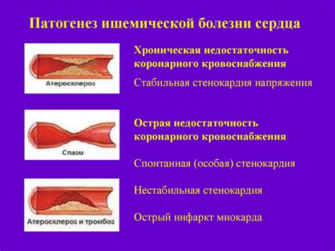 Лечение правого типа коронарного кровоснабжения