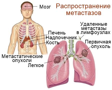 Лечение усиленного кровотока в лимфоузлах