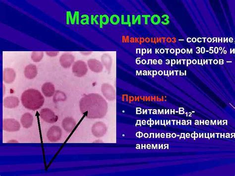 Макроциты ниже нормы: причины и последствия