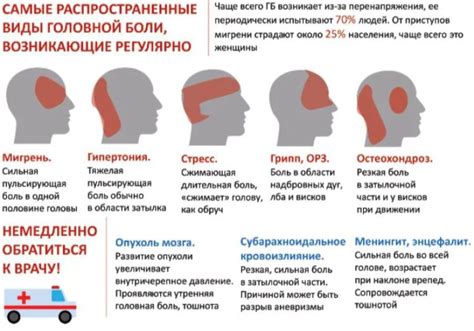 Мистическая интерпретация: сакральные значения болей головы