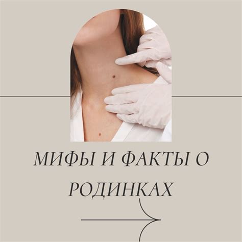 Мифы и факты о родинках сердцем