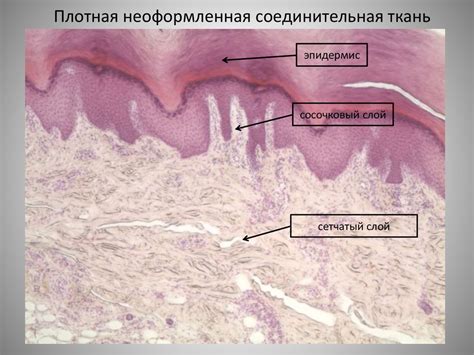 Неравномерное натяжение кожи и плотная окружающая ткань