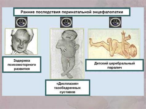 Осложнения и прогноз