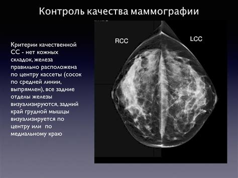 Повышенная электропроводность при маммографии