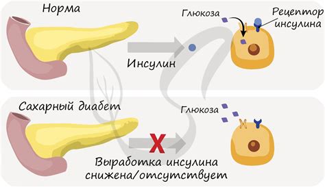 Поджелудочная железа с умеренно выраженным стромальным компонентом