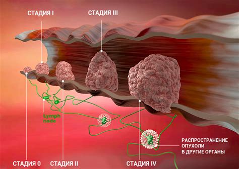 Положительная динамика при онкологии: значение и эффекты