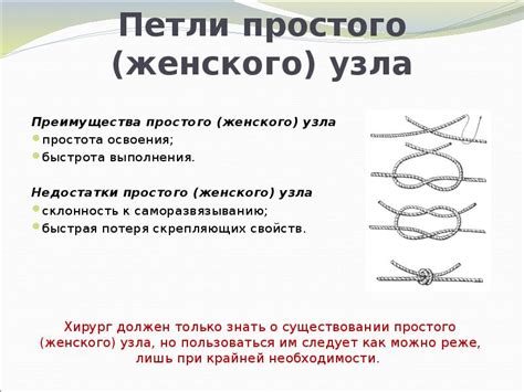 Преимущества раскрепленного узла