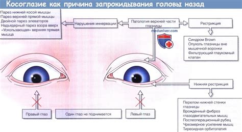 Причины запрокидывания головы курицой