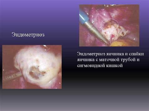 Проблемы, связанные с маточной трубой извитой