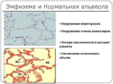 Разрушение капилляров