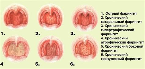 Сердце бьется у горла: что это значит