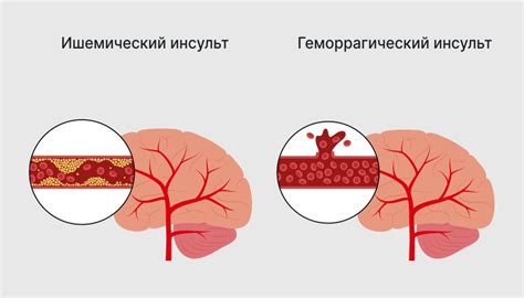 Симптомы "шизанутого" состояния и как их распознать