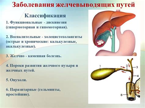 Симптомы высыхания желчного пузыря