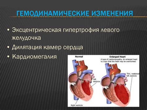 Симптомы и признаки расширения тени сердца