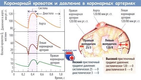 Симптомы правого типа коронарного кровоснабжения