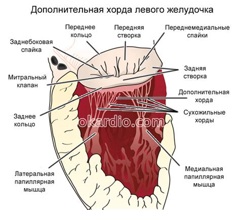 Симптомы удлиненной дуги левого желудочка