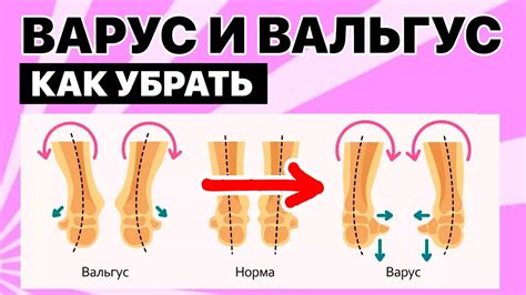 Улучшение вентиляции стопы