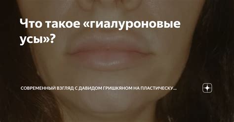 Физиологические причины появления причмокивания губами