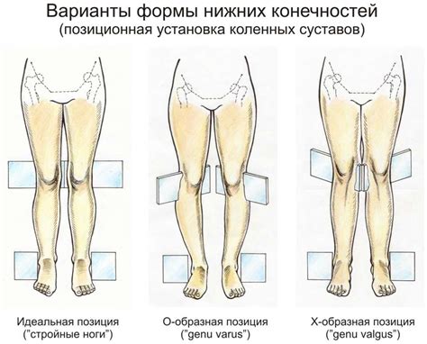 Форма колен у мужчин и женщин: различия и связь с гормональным фоном