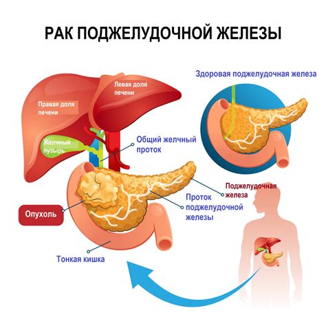 Экранирование хвоста поджелудочной железы: объяснение феномена