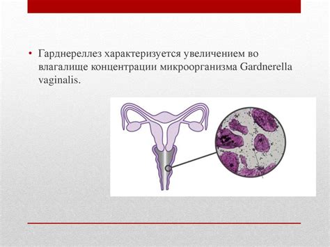  Гарднерелла вагиналис 