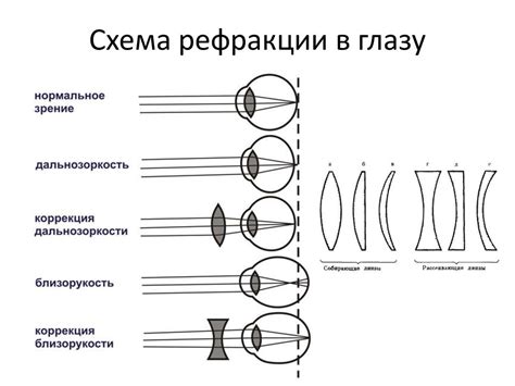  Как происходит расфокусировка зрения по желанию 